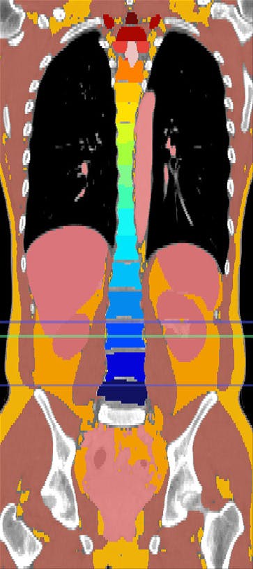 whole body segmentation image
