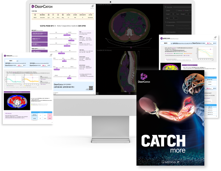 deepCatch_report_image