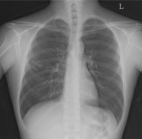 Original chest X-ray
