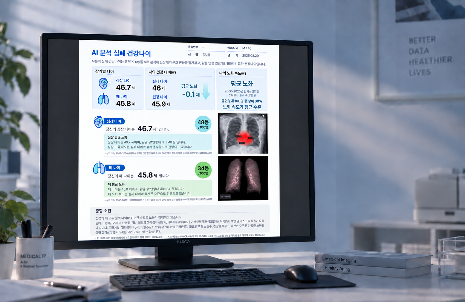 Heart and lung health-age analysis report displayed on a monitor
