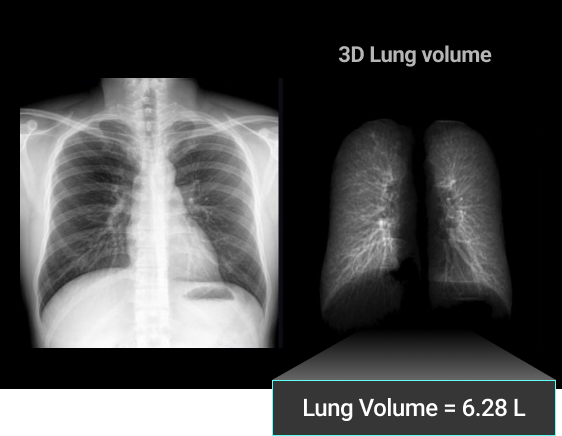 lung_01