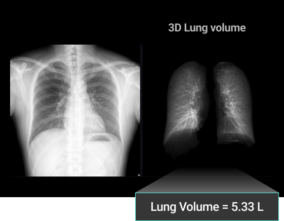 lung_02